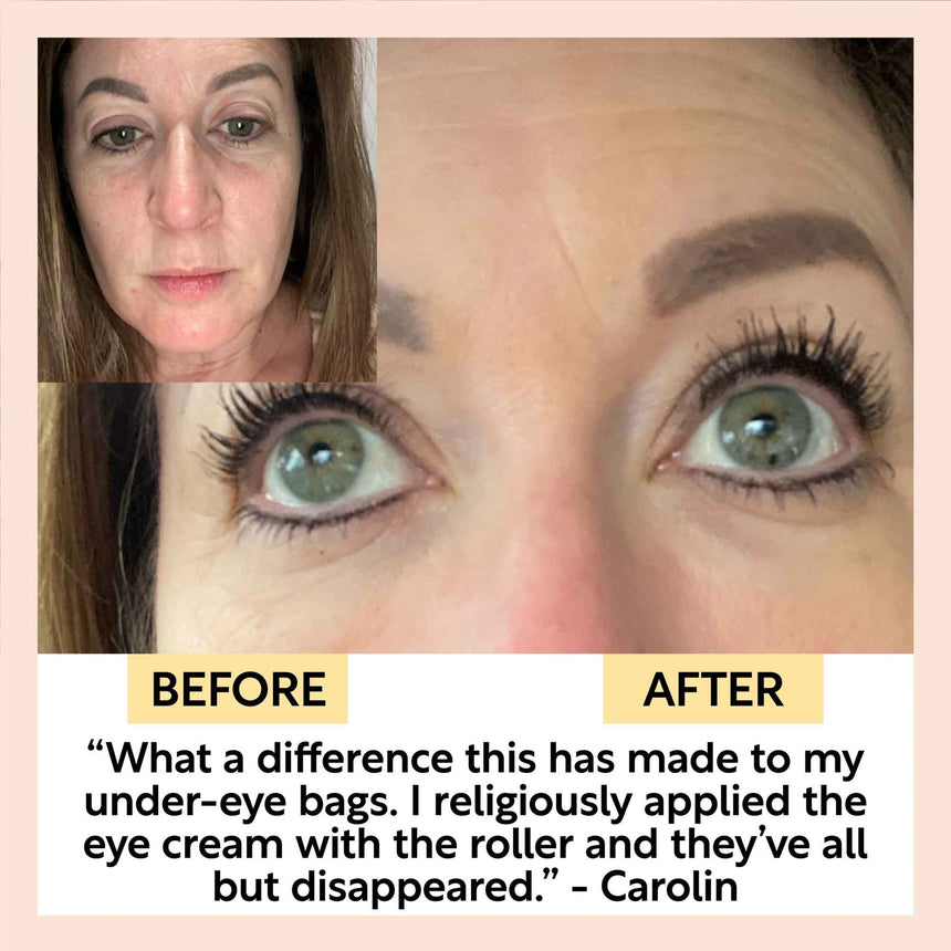 ***BACK SOON*** Eye Cream | Hyaluronic Acid & Coffee - mypure.co.uk