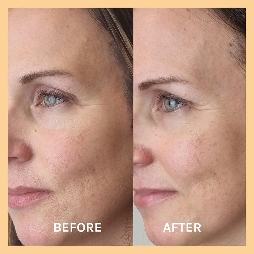 Miracle Vitamin C Mask - mypure.co.uk