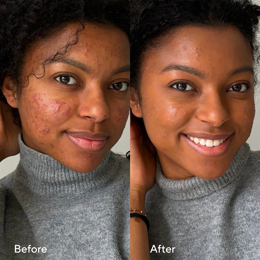 SKINONYM | Semi - Matte Peptide Foundation - mypure.co.uk