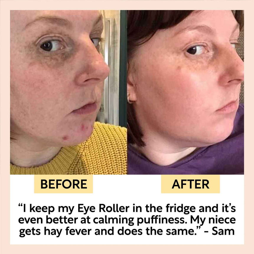 Eye Roller - mypure.co.uk