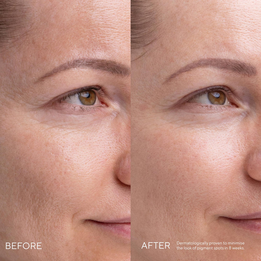 Kojic Alternative Pigment Serum - mypure.co.uk
