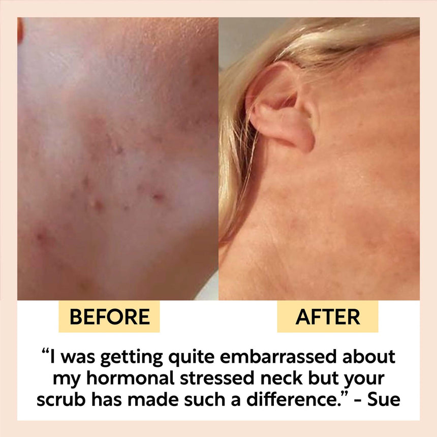 Natural Face Scrub | Citrus Blend for Dry Skin - mypure.co.uk